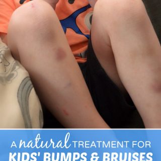 Our New Go-To Homeopathic - Natural - Treatment for Kids Bumps and Bruises at B-Inspired Mama